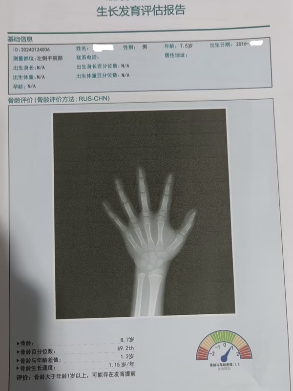 骨齡和身高有什么關(guān)系？每個孩子都有必要檢測嗎？